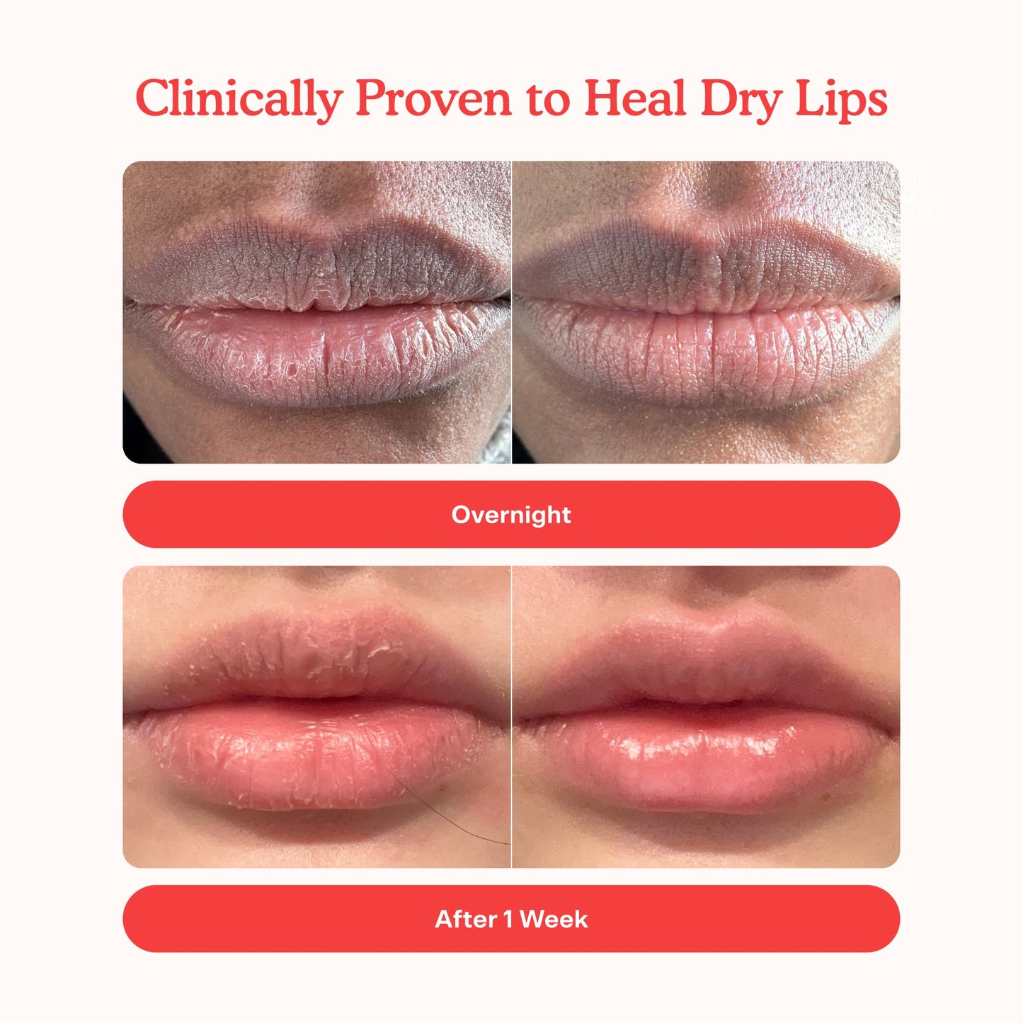 Tower 28 LipSoftie Tinted Lip Balm Treatment - Hydrating Glossy Balm + Overnight Lip Mask with Jojoba Oil + Shea Butter - Sweet, Cushiony Formula for Smooth, Soft Lips - Watermelon Kiwi (0.38 oz)
